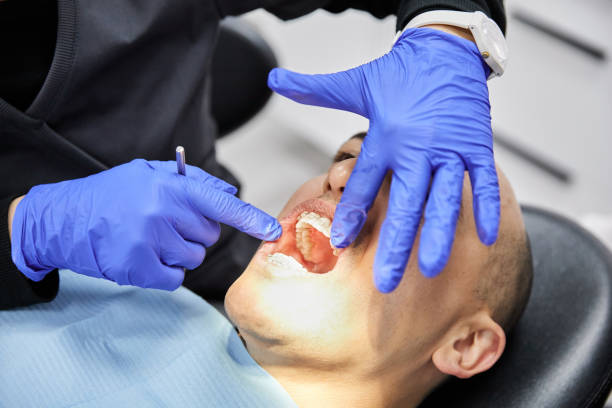  Rson, CA Emergency Dentist Pros