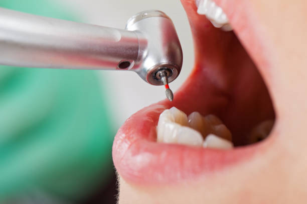 Best Weekend Emergency Dentist in Rson, CA